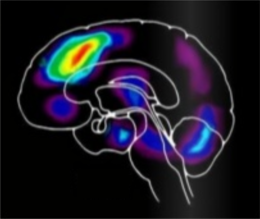 Activité du cerveau en mode adaptatif