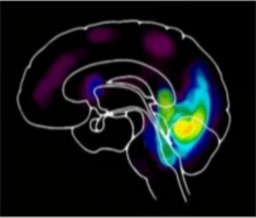 Activité du cerveau en mode automatique